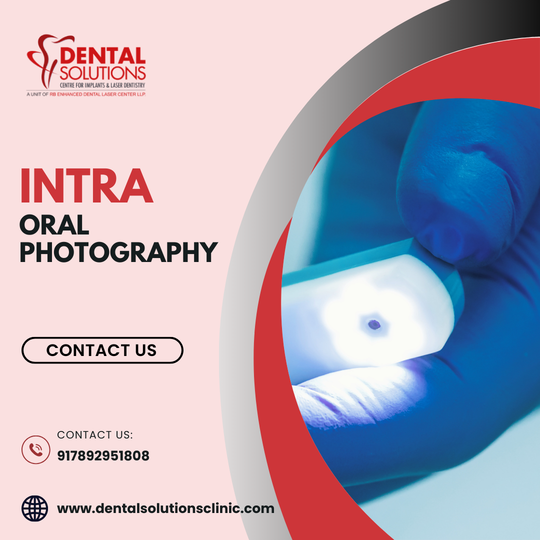Intra Oral Photography Bangalore-Dental Solutions