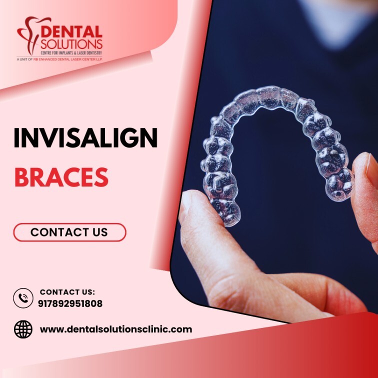 Invisalign Braces Cost in Bangalore-Dental Solutions