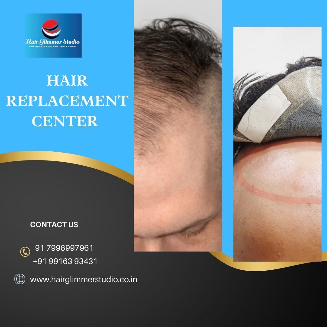 Hair Replacement center in Bangalore-HairGlimmer