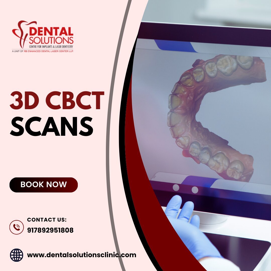 3D CBCT Scans in Bangalore-Dental Solutions
