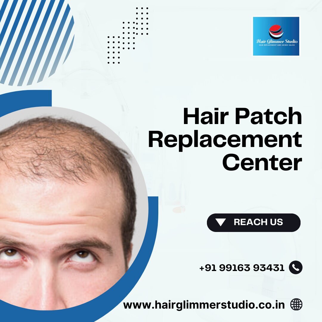 Hair Patch Replacement Center in Bangalore