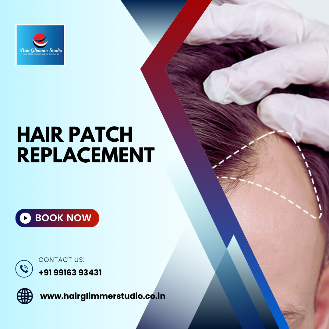 Hair Patch Replacement in Bangalore