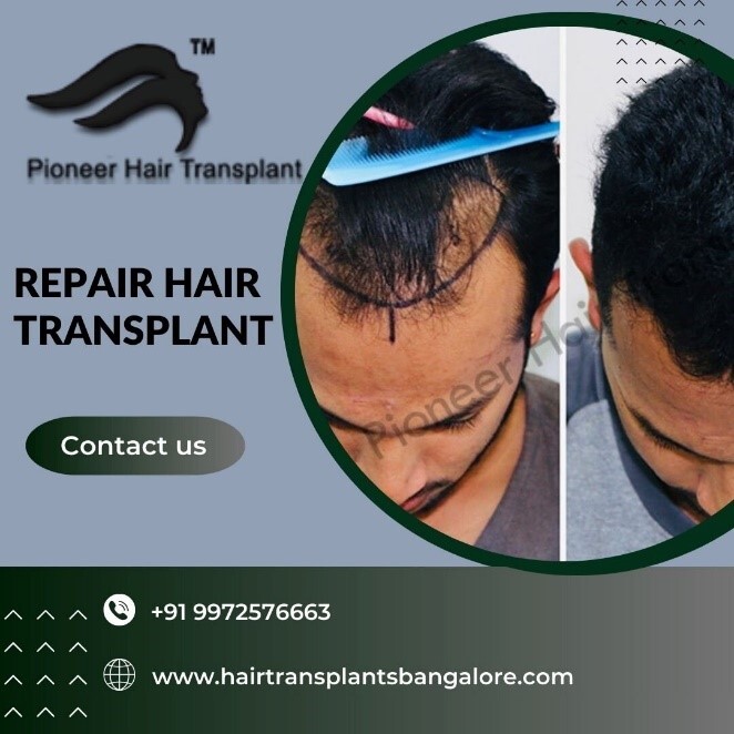 Pioneer-Repair Hair Transplant in Bangalore