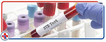 STD Test Fort Lauderdale Emergency