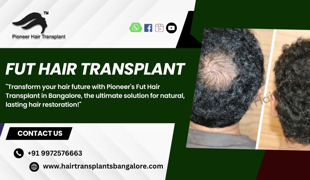 Fut Hair Transplant in Bangalore-Pioneer