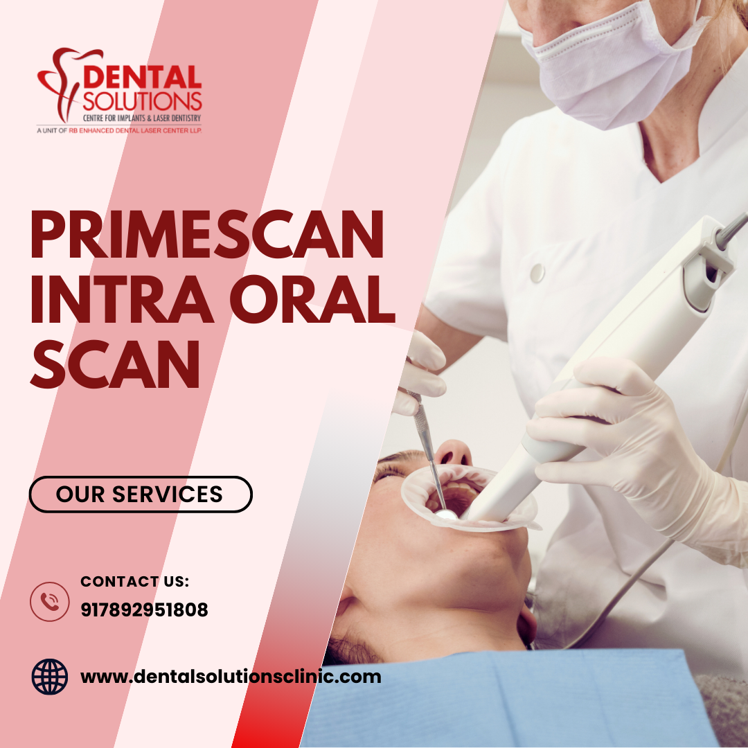 Primescan Intra Oral Scan-Dental Solutions