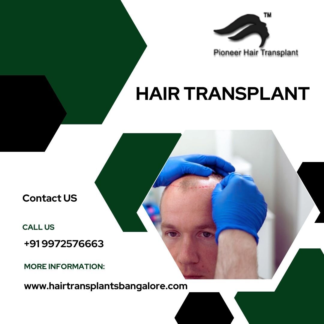 Pioneer Hair Transplant: Hair Transplant Cost in Bangalore Explained