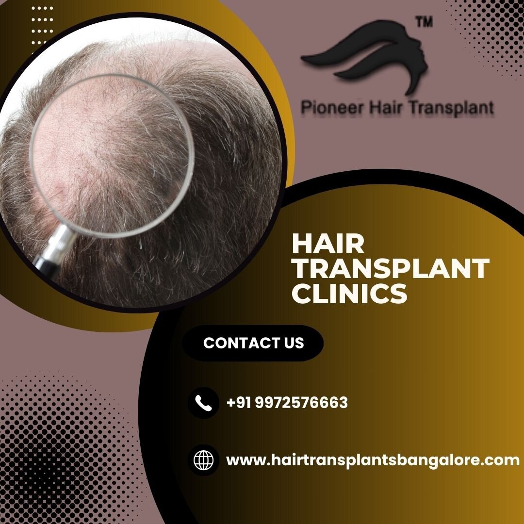 Hair Transplant Clinic Guide: By Pioneer