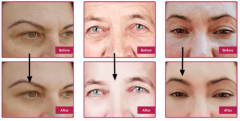 Lumiace REVIEW [5th and Glow Best Creation] Anti-Eye Wrinkle Fac