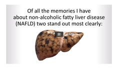 Non Alcoholic Fatty Liver Strategy Review