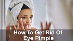 Eye Pimple - How To Get Rid Of A Stye - Glowy Dowy