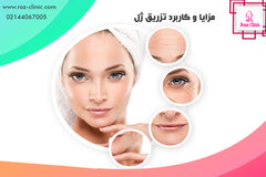 \u062a\u0632\u0631\u06cc\u0642 \u0698\u0644 - \u0645\u0632\u0627\u06cc\u0627\u060c \u0639\u0648\u0627\u0631\u0636 \u0648 \u0647\u0632\u06cc\u0646\u0647 \u062a\u0632\u0631\u06cc\u0642 \u0641\u06cc\u0644\u0631 | \u06a9\u0644\u06cc\u0646\u06cc\u06a9 \u067e\u0648\u0633\u062a \u0648 \u0645\u0648 \u0631\u0632