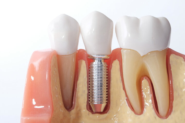 What is the difference between a dentist and a periodontist? - P