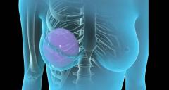 Breast cancer treatment Delhi\/India-Patient education and resour
