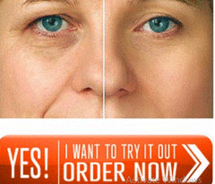 Janiche Cream [Janiche Skin] Remove Dark Circles! Serum Review