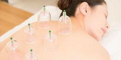 Dry Cupping - Chichester Chiropractic Health Centre