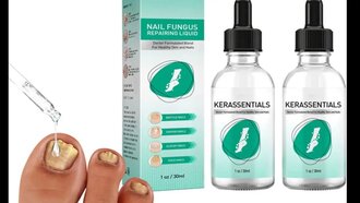 Kerassentials Toenail Fungus \u2013 Most Vital Tips