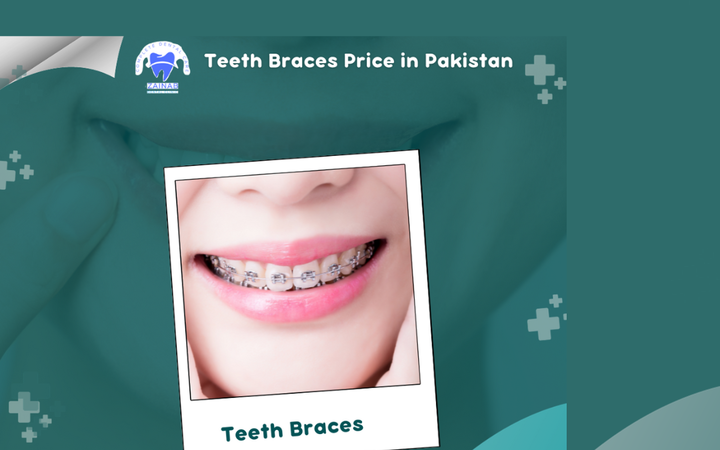 Affordable Dental Solutions in Pakistan Prices and Options