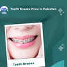 Affordable Dental Solutions in Pakistan Prices and Options