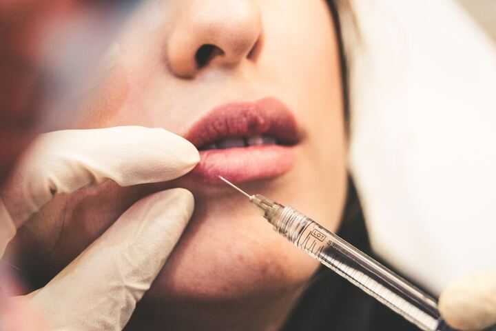 Dermal fillers vs Lipolytic injections