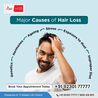 What Are the Most Effective Hair Loss Treatments?