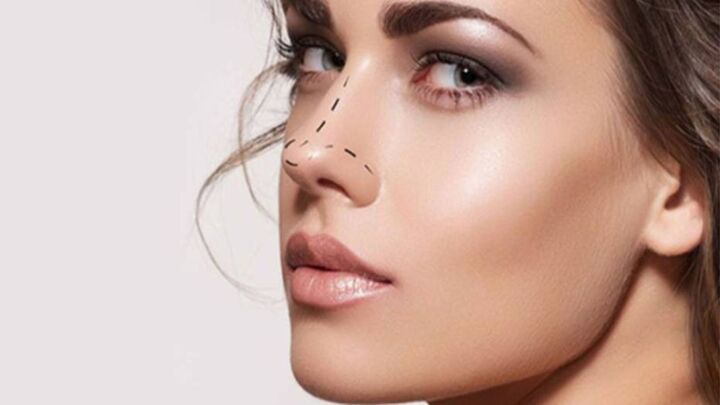 Improve Face Aesthetics With Rhinoplasty in Hyderabad