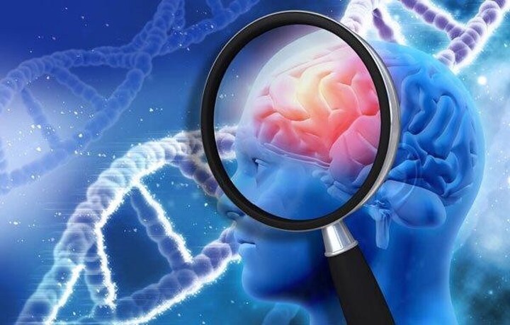 Japan Neurological Biomarkers Market Trends, Size, Industry Overview, Forecast 2024-2032