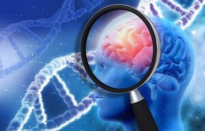 Japan Neurological Biomarkers Market Trends, Size, Industry Overview, Forecast 2024-2032