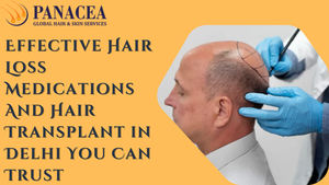 Beyond the Hype: Effective Hair Loss Medications And Hair Transplant in Delhi You Can Trust