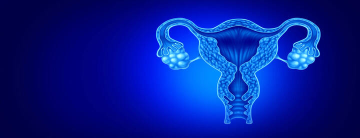 Will IVF work for PCOS?