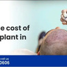 Hair Transplant Cost in India: Factors, Average Prices, and Considerations