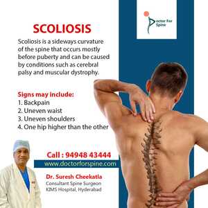  Scoliosis Treatment in Hyderabad- Dr. Suresh Cheekatla