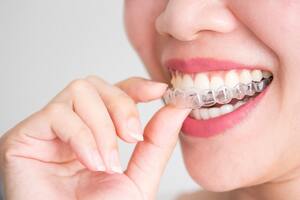Why Do Dentists Suggest Wearing Mouthguards For Teeth?
