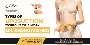 Achieve Your Dream Body with 360 Liposuction in Dubai