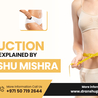 Achieve Your Dream Body with 360 Liposuction in Dubai