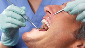 How Can Veneers Geneva Transform Your Smile in Just Days?