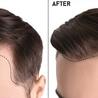 Basic Facts About Organin Hair Loss Treatment