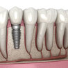What is the Need for Cosmetic Dentistry?