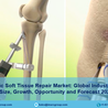 Orthopedic Soft Tissue Repair Market Size, Analysis Key Players, Demand, Share and Report 2024-2032