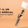 Faut-il un suivi sp\u00e9cial pour l\u2019entretien des implants dentaires ?