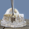 The Role of Bone Density in Dental Implant Success Perth