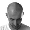 Get Scalp Micropigmentation Done With Expert Hands Via Made Hair Academy