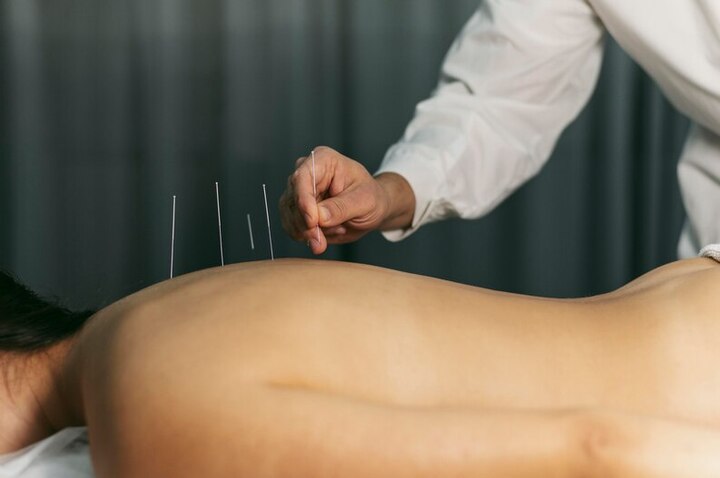 Acupuncture for Fertility: Empowering Your Journey to Parenthood
