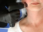 Morpheus8 the Ultimate Guide to Skin Rejuvenation