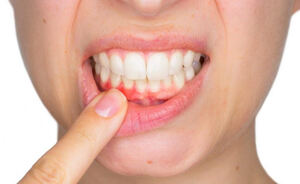 How Long Does A Tooth Infection Go Untreated?