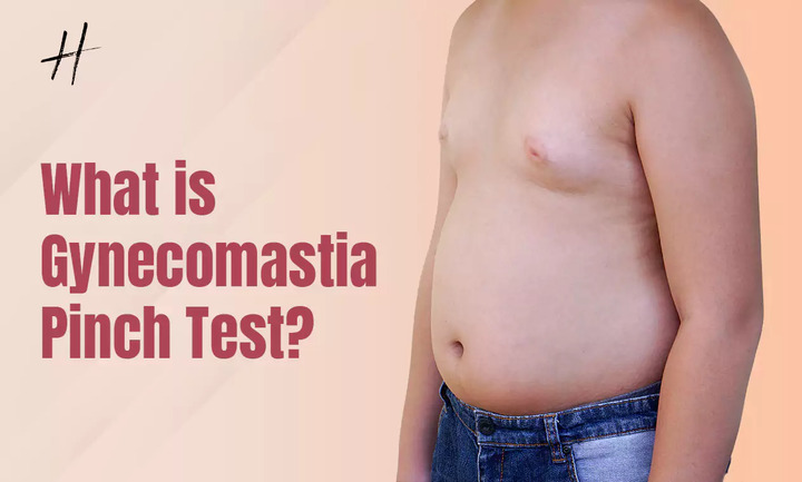 Gynecomastia Pinch Test — A Comprehensive Guide