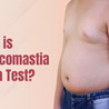 Gynecomastia Pinch Test \u2014 A Comprehensive Guide