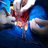 Undergoing Heart Failure Surgery Can Increase Chances of Survival