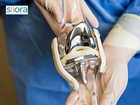 Alternatives to Knee Replacement Surgery - A Detailed Guide