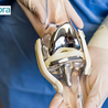 Alternatives to Knee Replacement Surgery - A Detailed Guide